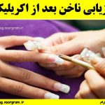 بازیابی بعد از اکریلیک
