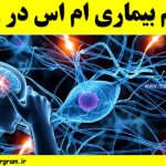 علائم بیماری ام اس در زنان