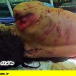حمله سگ های ولگرد به یک کودک در شهر ری
