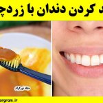 سفید کردن دندان با زردچوبه