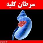 سرطان کلیه