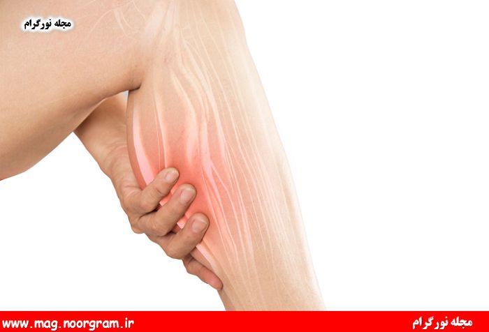 درمان گرفتگی عضلات ساق پا