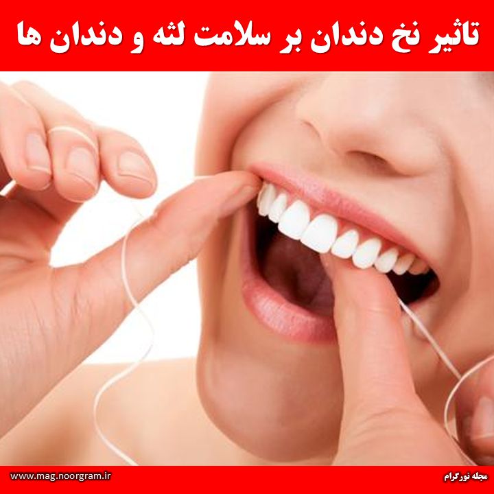 تاثیر نخ دندان بر سلامت لثه و دندان ها