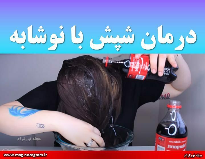 درمان شپش با نوشابه