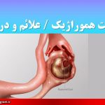 کیست هموراژیک