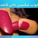 تعبیر خواب شکستن ناخن کاشته شده